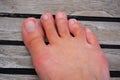 Woman's foot. Hammer toes on the deck of a sailing boat. Bare feet. Royalty Free Stock Photo