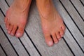 Woman's foot. Hammer toes on the deck of a sailing boat.