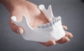 The woman's hand holds a transparent orthodontic aligner device on teeth cast