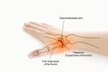 Woman\'s hand with thumb pain problem, body injured concept.