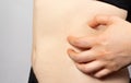 The woman scratches the skin of the side of the abdomen, scabies. Contagious skin disease, dermatitis and skin itching. Allergic