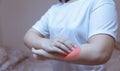 woman scratching arm from having itching allergic reaction to insect bites, dermatitis, food, drugs.