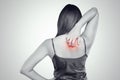 Woman scratching her itchy back with allergy rash Royalty Free Stock Photo
