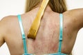 Woman scratching her itchy back using scratcher Royalty Free Stock Photo