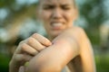 A woman scratching her itchy mosquito bite. Tropical climate danger Royalty Free Stock Photo