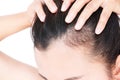 Woman serious hair loss problem for health care shampoo and beau Royalty Free Stock Photo