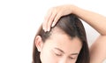 Woman serious hair loss problem for health care shampoo and beau Royalty Free Stock Photo