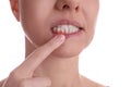 Woman showing inflamed gums on white background, closeup view