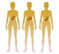 Woman silhouette with stomach, pancreas, spleen location on body. Illustration