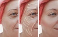 Woman skin face wrinkles effect correction before and after procedures, arrow Royalty Free Stock Photo