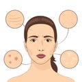 Woman skin problem vector illustration. Female face with skins problematic areas