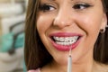 woman smiling at dental brace checkup