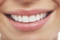 Woman Smiling With Prefect White Teeth Royalty Free Stock Photo