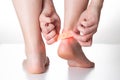 A woman sticks a medical plaster for the treatment of warts on the foot. Close-up Royalty Free Stock Photo