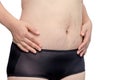 Woman with stretchmarks on her belly Royalty Free Stock Photo