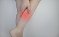 A woman suffers from pain in the calves. Stretching the calf muscle, varicose veins, leg cramps, or myositis. Orthopedic doctor