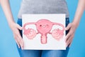 Woman take health uterus billboard Royalty Free Stock Photo