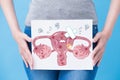 Woman with unhealth uterus Royalty Free Stock Photo