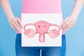 Woman take uterus billboard Royalty Free Stock Photo