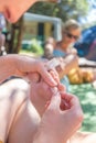 Woman taking sea urchin spine out of her friends sole using medical needle.