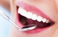 Woman teeth and a dentist mirror
