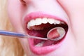 Woman teeth and dentist mouth mirror Royalty Free Stock Photo