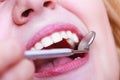 Woman teeth and dentist mouth mirror Royalty Free Stock Photo