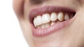 Woman teeth smiling mouth