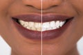 Woman Teeth Before And After Whitening Royalty Free Stock Photo