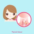 Woman with thyroid cancer