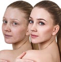 Woman before and after treatment and makeup. Royalty Free Stock Photo