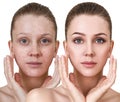 Woman before and after treatment and makeup. Royalty Free Stock Photo