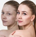 Woman before and after treatment and makeup. Royalty Free Stock Photo