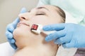 Woman undergoes the procedure of medical micro needle therapy with a modern medical instrument derma roller. Royalty Free Stock Photo