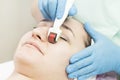 Woman undergoes the procedure of medical micro needle therapy with a modern medical instrument derma roller. Royalty Free Stock Photo