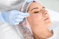 Woman undergoing face biorevitalization procedure in salon, closeup. Royalty Free Stock Photo
