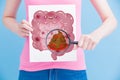 Woman with unhealth intestine Royalty Free Stock Photo