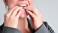 A woman uses transparent retainers to whiten teeth