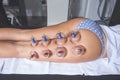 Woman on vacuum legs treatment