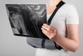 Woman wearing arm sling and looking at X-ray image. Female suffering from shoulder, clavicle, acromion fracture, strain Royalty Free Stock Photo