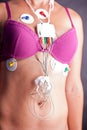 Woman wearing a Holter Heart Monitor