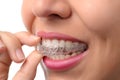 Woman wearing orthodontic silicone trainer Royalty Free Stock Photo