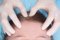 Woman, in a white coat, doing a head massage, Spa treatments, close-up Royalty Free Stock Photo