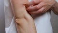 A woman in a white T-shirt strongly combs her hand with her nails in close-up. Scabies, eczema, giardia