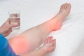 A woman whose leg pain in the joints holds a pill and a glass of water. The concept of treatment of arthritis and arthrosis with