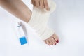 Woman is wrapping her leg with sprained ankle with elastic bandage  on white background. Twisted bandaged ankle and gel on Royalty Free Stock Photo