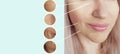 Woman wrinkles face before aging treatment correction difference mature after procedures collage Royalty Free Stock Photo