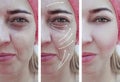 Woman wrinkles face before and after difference therapy correction, arrow Royalty Free Stock Photo