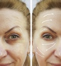 woman wrinkles before and after procedures Royalty Free Stock Photo