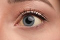 Woman with yellow eyes as background, closeup. Liver problems symptom